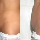 Przedsiębiorstwo 1 wizerunek CHIRURGIA PLASTYCZNA KNAKIEWICZ Lekarze - Chirurgia Plastyczna w Wrocław DS