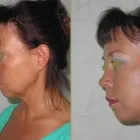 Przedsiębiorstwo 2 wizerunek CHIRURGIA PLASTYCZNA KNAKIEWICZ Lekarze - Chirurgia Plastyczna w Wrocław DS