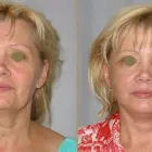 Przedsiębiorstwo 4 wizerunek CHIRURGIA PLASTYCZNA KNAKIEWICZ Lekarze - Chirurgia Plastyczna w Wrocław DS