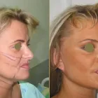 Przedsiębiorstwo 7 wizerunek CHIRURGIA PLASTYCZNA KNAKIEWICZ Lekarze - Chirurgia Plastyczna w Wrocław DS