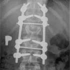 Przedsiębiorstwo 5 wizerunek GABINET LEKARSKI KONSULTACJE NEUROCHIRURGICZNE DR MED. JAROSŁAW ANDRYCHOWSKI Lekarze - Neurochirurdzy w Warszawa MZ