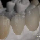 Przedsiębiorstwo 3 wizerunek KLEELAB Protetyczne Usługi w Piastów MZ