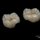 Przedsiębiorstwo 5 wizerunek KLEELAB Protetyczne Usługi w Piastów MZ