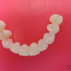 Przedsiębiorstwo 1 wizerunek NEW SMILE Lekarze - Stomatolodzy w Rybnik SL