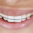 Przedsiębiorstwo 5 wizerunek PŁAZA-DENT BOGDAN PŁAZA Lekarskie, Stomatologiczne Gabinety - Wyposażenie w Warszawa MZ