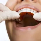 Przedsiębiorstwo 10 wizerunek PŁAZA-DENT BOGDAN PŁAZA Lekarskie, Stomatologiczne Gabinety - Wyposażenie w Warszawa MZ