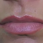 Przedsiębiorstwo 1 wizerunek PRYWATNY GABINET DERMATOLOGICZNY SŁAWOMIR KĘCKI Lekarze - Dermatolodzy w Opole OP