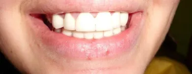 Przedsiębiorstwo 5 wizerunek ART DENT PRZYCHODNIA STOMATOLOGICZNO-PROTETYCZNA Lekarze - Stomatolodzy w Rybnik SL