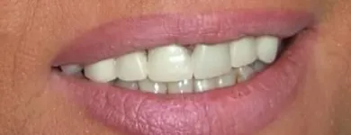 Przedsiębiorstwo 9 wizerunek ART DENT PRZYCHODNIA STOMATOLOGICZNO-PROTETYCZNA Lekarze - Stomatolodzy w Rybnik SL