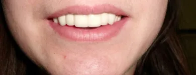 Przedsiębiorstwo 10 wizerunek ART DENT PRZYCHODNIA STOMATOLOGICZNO-PROTETYCZNA Lekarze - Stomatolodzy w Rybnik SL