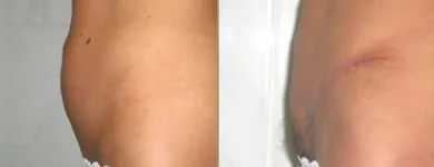 Przedsiębiorstwo 1 wizerunek CHIRURGIA PLASTYCZNA KNAKIEWICZ Lekarze - Chirurgia Plastyczna w Wrocław DS