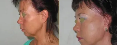 Przedsiębiorstwo 2 wizerunek CHIRURGIA PLASTYCZNA KNAKIEWICZ Lekarze - Chirurgia Plastyczna w Wrocław DS