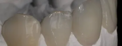 Przedsiębiorstwo 3 wizerunek KLEELAB Protetyczne Usługi w Piastów MZ