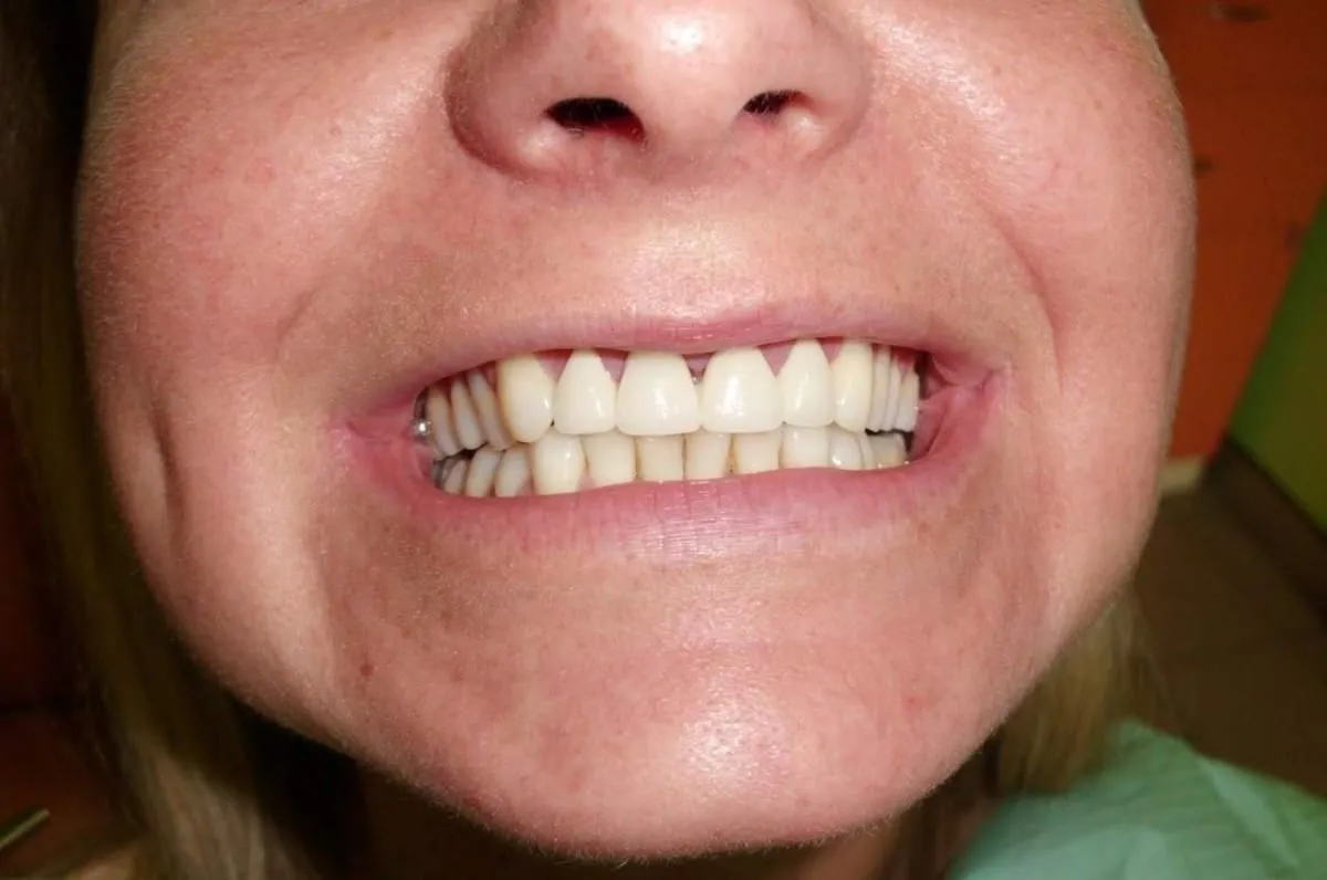 Przedsiębiorstwo 4 wizerunek ART DENT PRZYCHODNIA STOMATOLOGICZNO-PROTETYCZNA