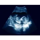 GABINET GINEKOLOGICZNY AMED